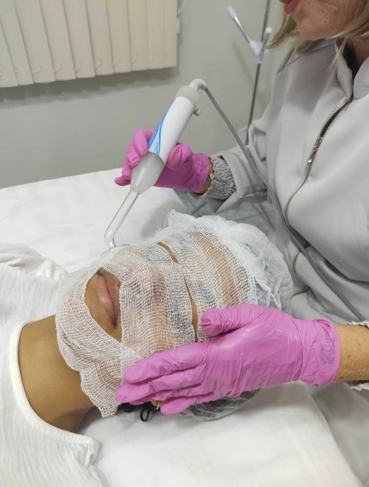 Limpeza de Pele com Radiofrequência